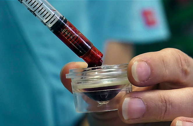 bilan sanguin vétérinaire